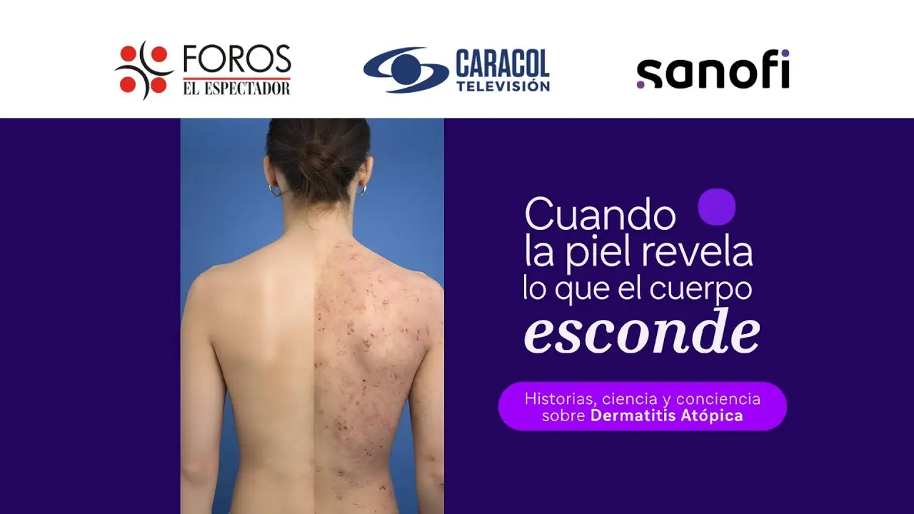 EN VIVO: Foro: Cuando la piel revela lo que el cuerpo esconde