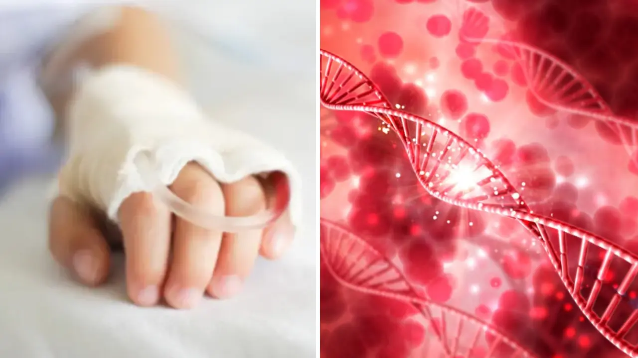 ¿Qué es la hemofilia, enfermedad que padecía Kevin Acosta, y por qué podría ser mortal?