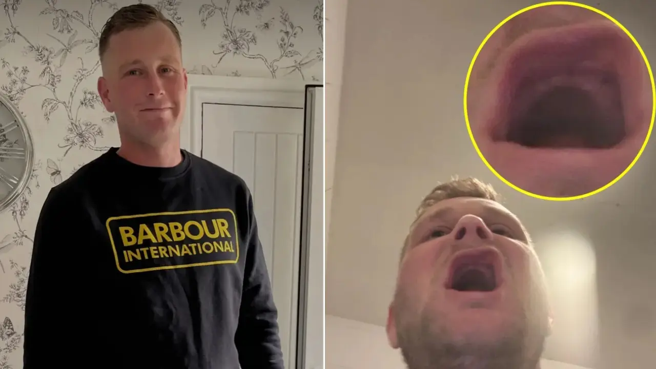 Viajó al extranjero para arreglar sus dientes y terminó sin poder comer: tratamiento salió mal